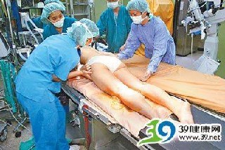 大陆客赴台整形 “腿雕术”最热门