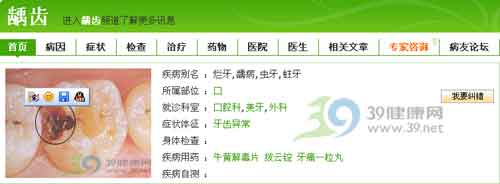 帮您搞定小儿龋齿